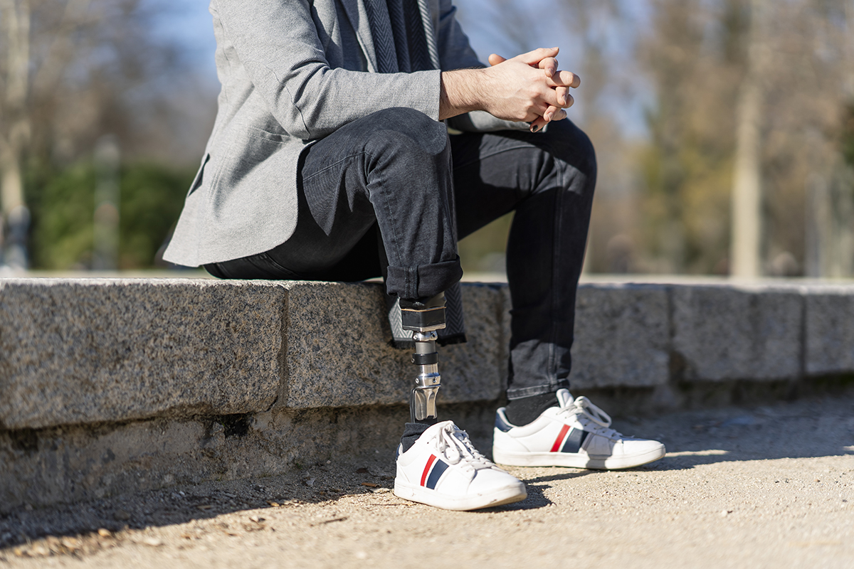 Closeup shot of a disabled young man with foot prosthesis sitting outdoor