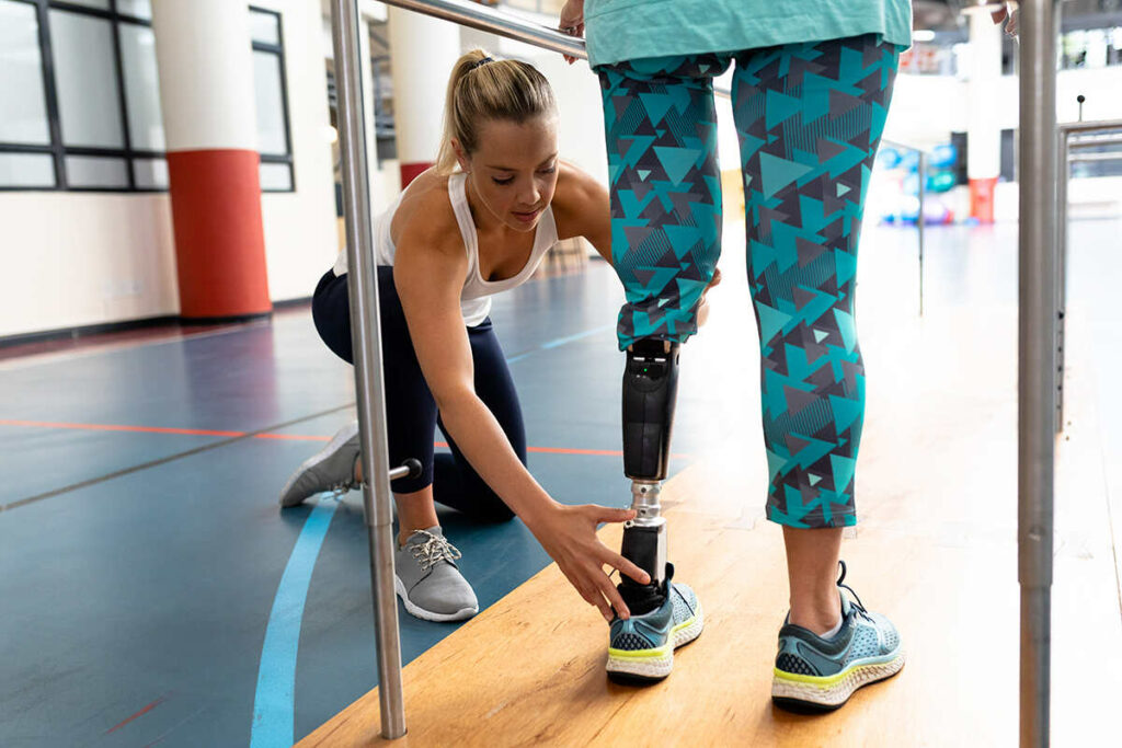 A photo of a person receiving prosthetic rehabilitation after a lower extremity amputation due to diabetes-related complications.