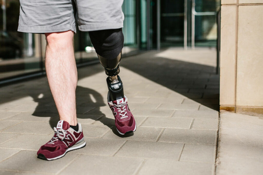 Man using an microprocessor foot taking a walk - Photo credit Ottobock