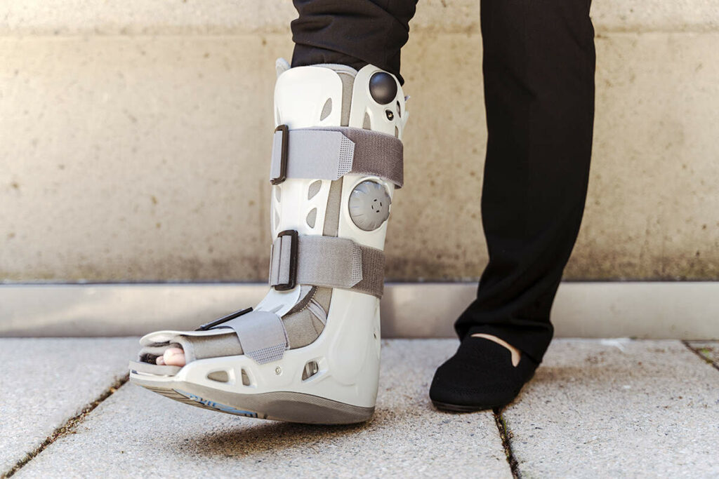 Woman wearing an ankle foot prosthesis standing outside
