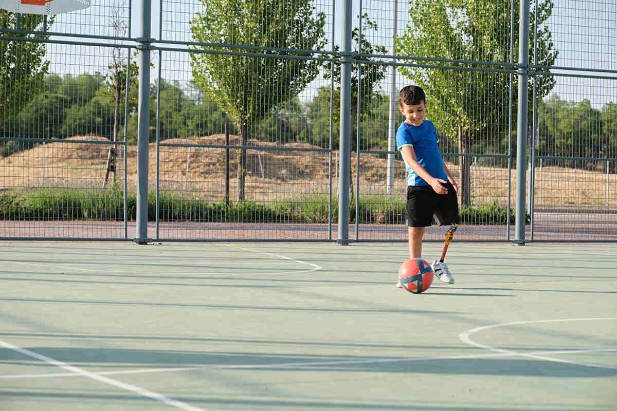 Young person playing soccer outside on a sunny day wearing an above the knee leg prosthetic