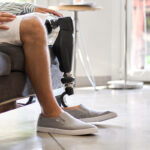 Man sitting down indoors with an above the knee amputation wearing a bionic advanced knee and leg prosthetic