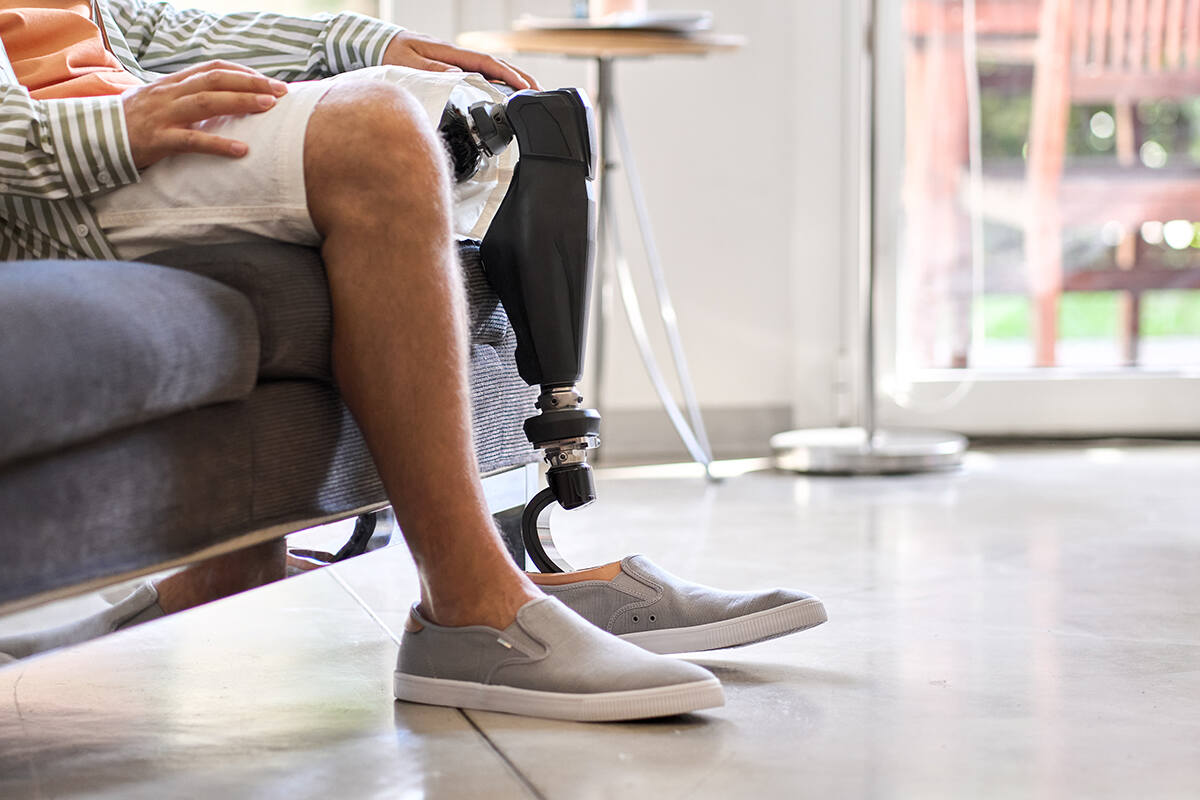 Man sitting down indoors with an above the knee amputation wearing a bionic advanced knee and leg prosthetic