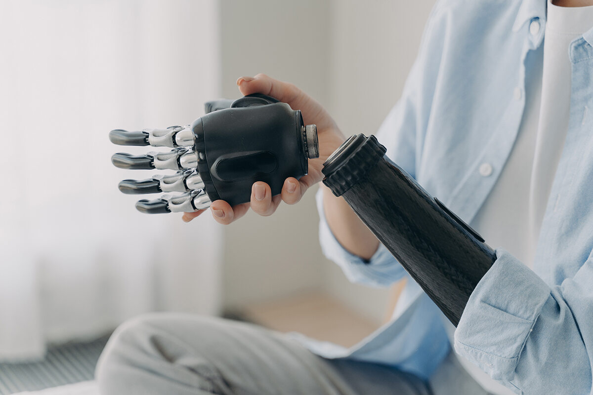 Attaching a robotic hand to an prosthetic arm. Black carbon fiber color