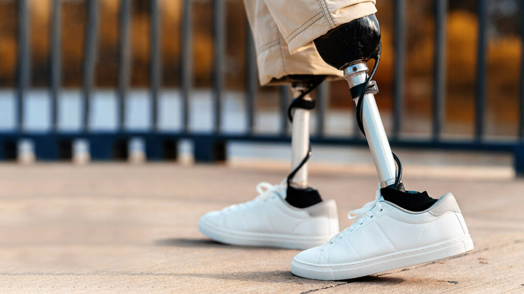 A double sided amputee walking on his prosthetic legs and feet outside on a sunny day