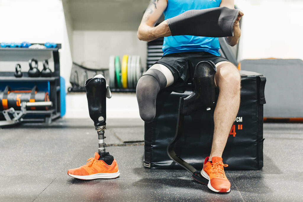 A person switching his prosthetic leg after workout utilizing a vacuum socket suspension system