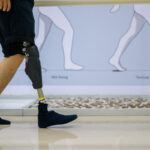 Person walking indoors with an above the knee amputation wearing an advanced knee and leg prosthetic