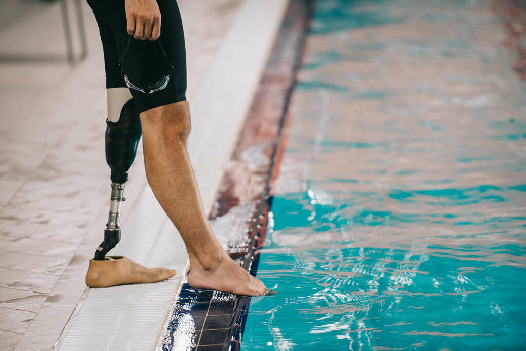Person with a waterproof leg getting ready for a swim in the pool