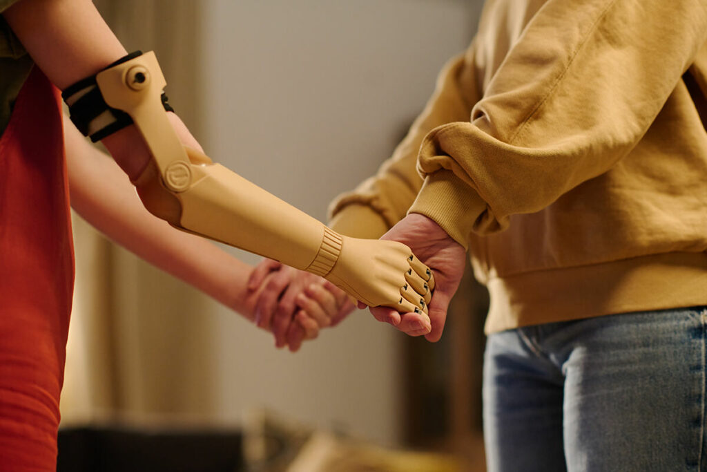 Wearing a prosthetic arm and hand holding hands