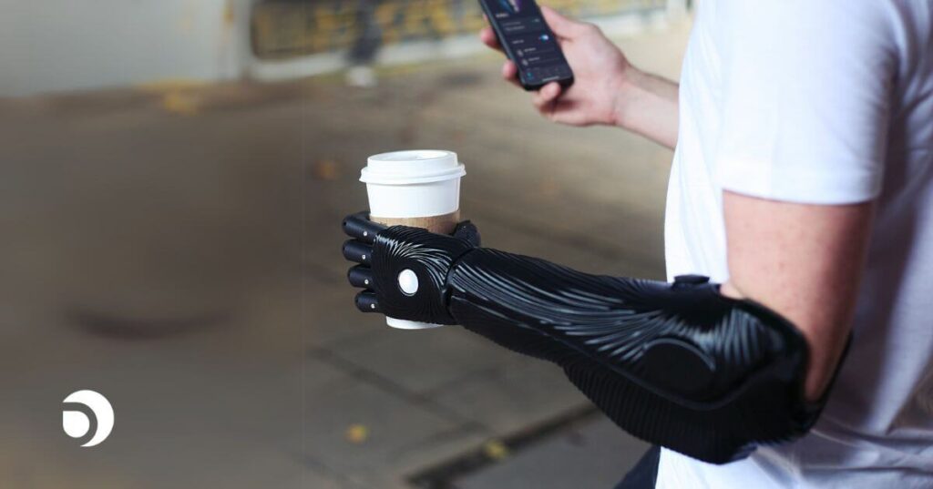 Robotic Finger Prosthetics: How It Works & Who Can Use It - Is Brave