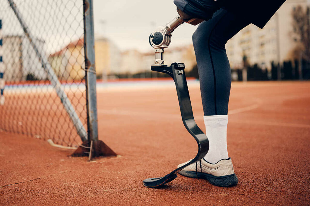 Man wearing a carbon fibre prosthetic leg and socket outdoors before a workout