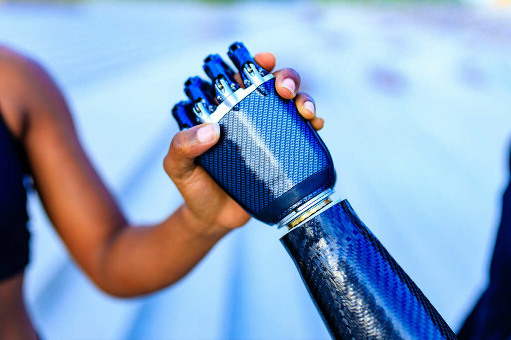 High five with an advanced bionic hand and arm