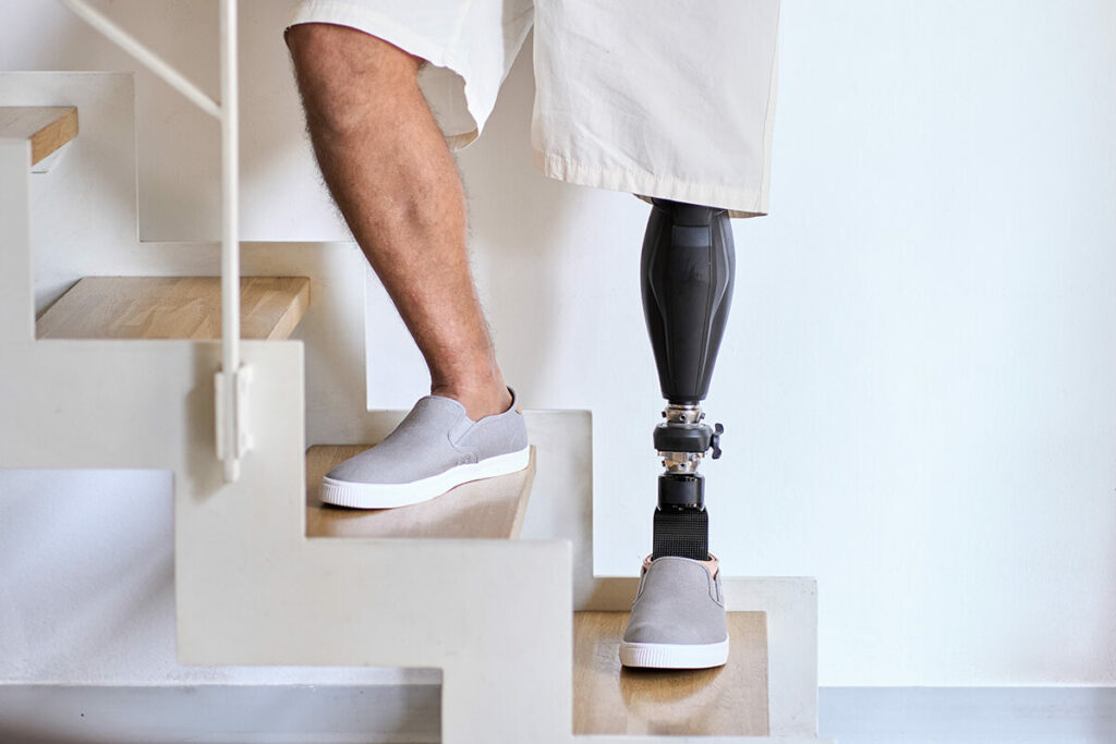 Man standing in stairs with his advanced bionic knee and leg prosthesis