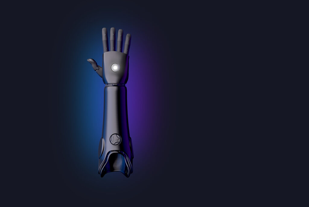 the Hero arm from Open Bionics - photo credit Open Bionics