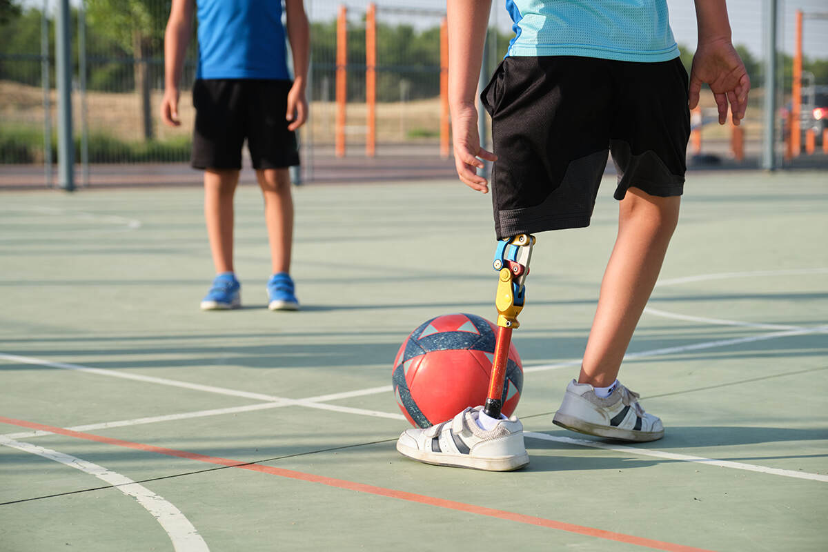Kid with an above knee advanced robotic leg prosthetic playing soccer outdoors