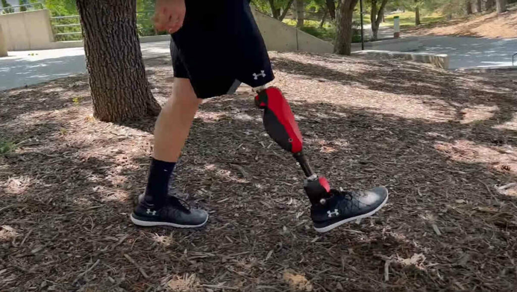 The advanced Utah Bionic leg in action, walking down a slope outdoors - Photo credit university of utah - youtube