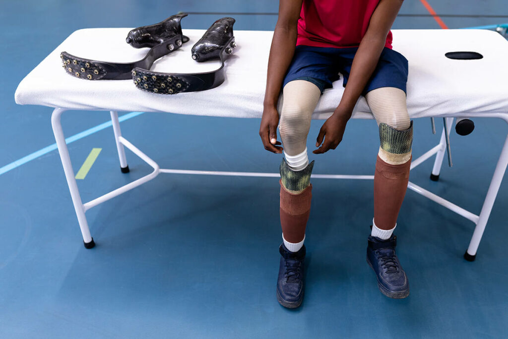 Man with a customized prosthetic cover on both of his amputated legs