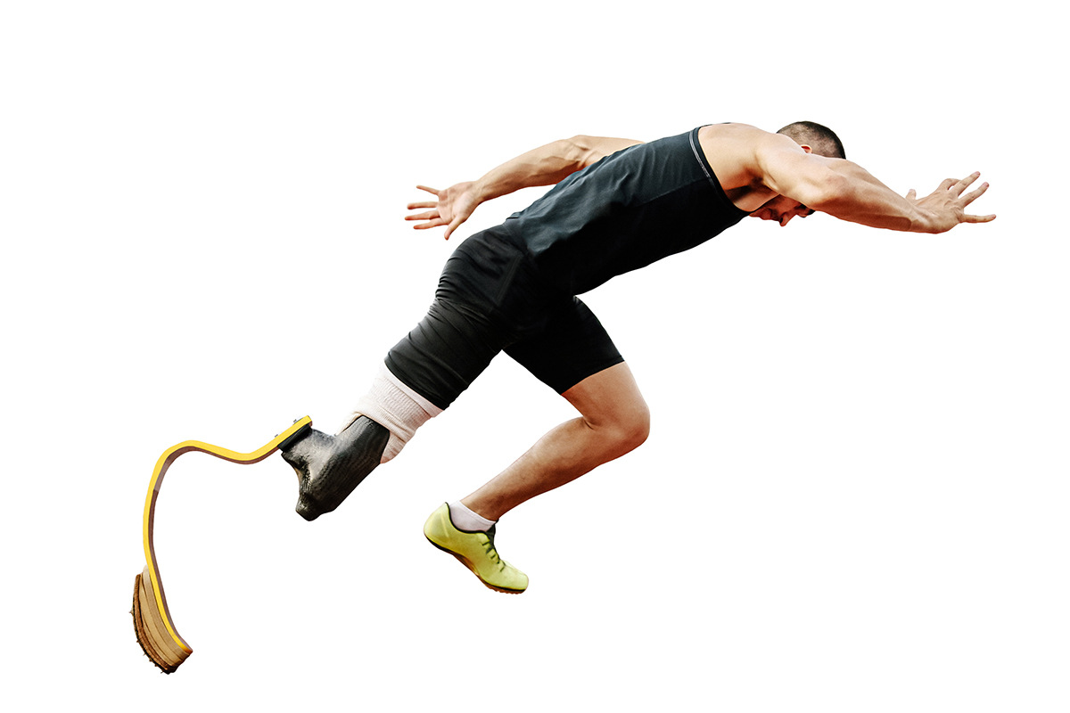 Benefits of a carbon fiber prosthetic leg