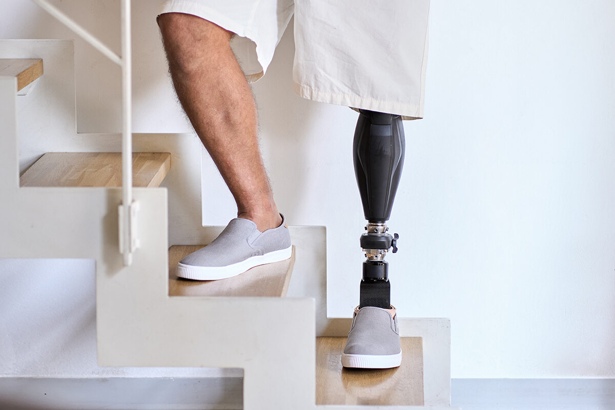 Man standing in stairs with his advanced bionic knee and leg prosthesis