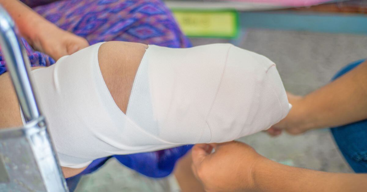 A close-up of a person's leg wrapped in a bandage after a below-knee amputation, with a caregiver providing support.