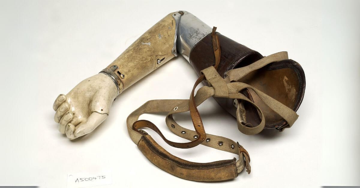 An early prosthetic arm featuring a wooden hand, aluminum arm, and leather straps for attachment, representing 19th-century prosthetic technology