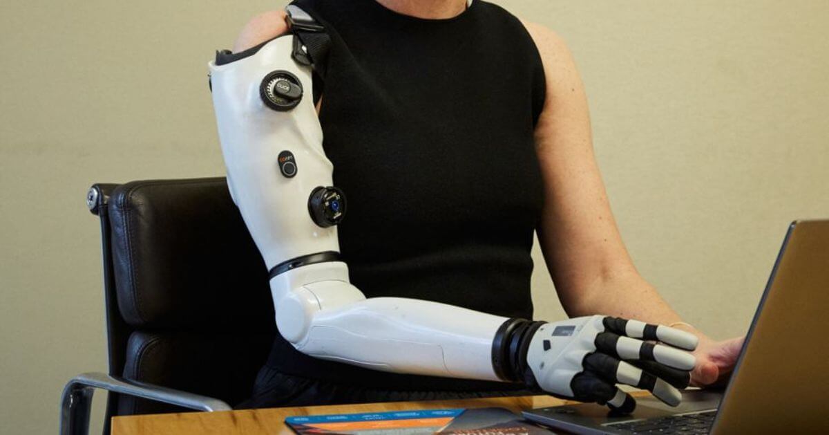 Sarah De Lagarde wearing the white AI-powered bionic arm while working on a laptop