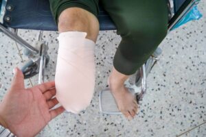 A person with a freshly bandaged leg sits in a wheelchair, viewed from above.