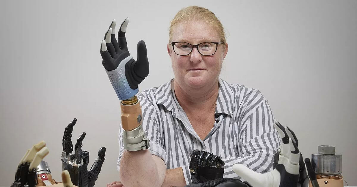 Karin, the first person who received a bionic arm fused in skeleton and nerves, showcasing it with other prosthetic hands in the table