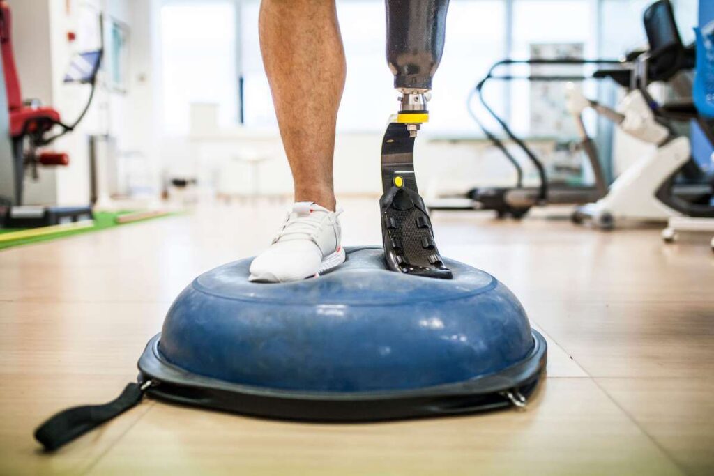 A person with a prosthetic leg balances on a blue stability dome in a physical therapy or rehabilitation setting.