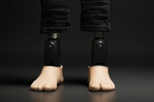 Close-up of two advanced below-knee prosthetic legs with beige foot covers shaped like toes