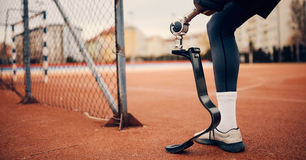 A close-up of a person with a lower limb prosthesis on a sports field, standing next to a fence.