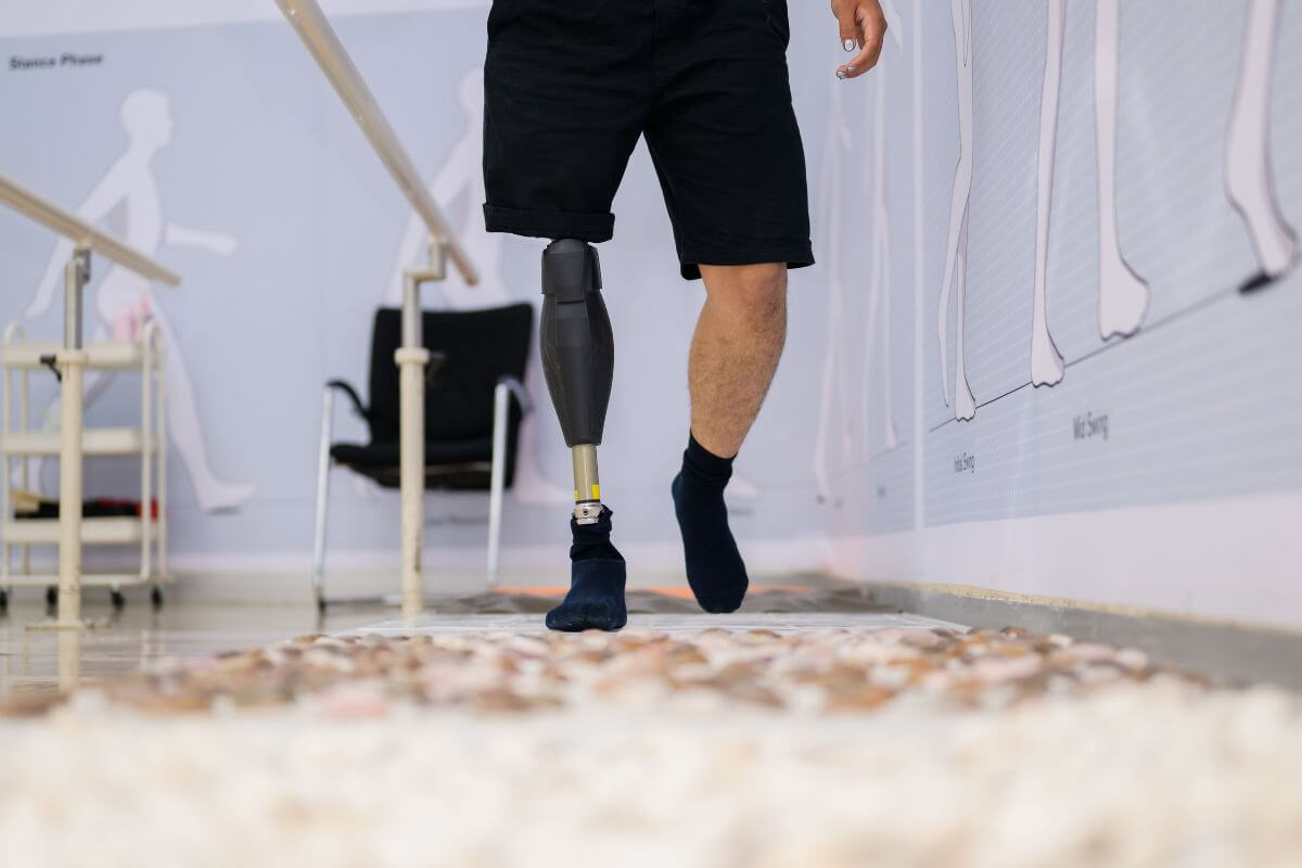 Person walking with a knee disarticulation prosthesis while using a support bar for stability during rehabilitation.
