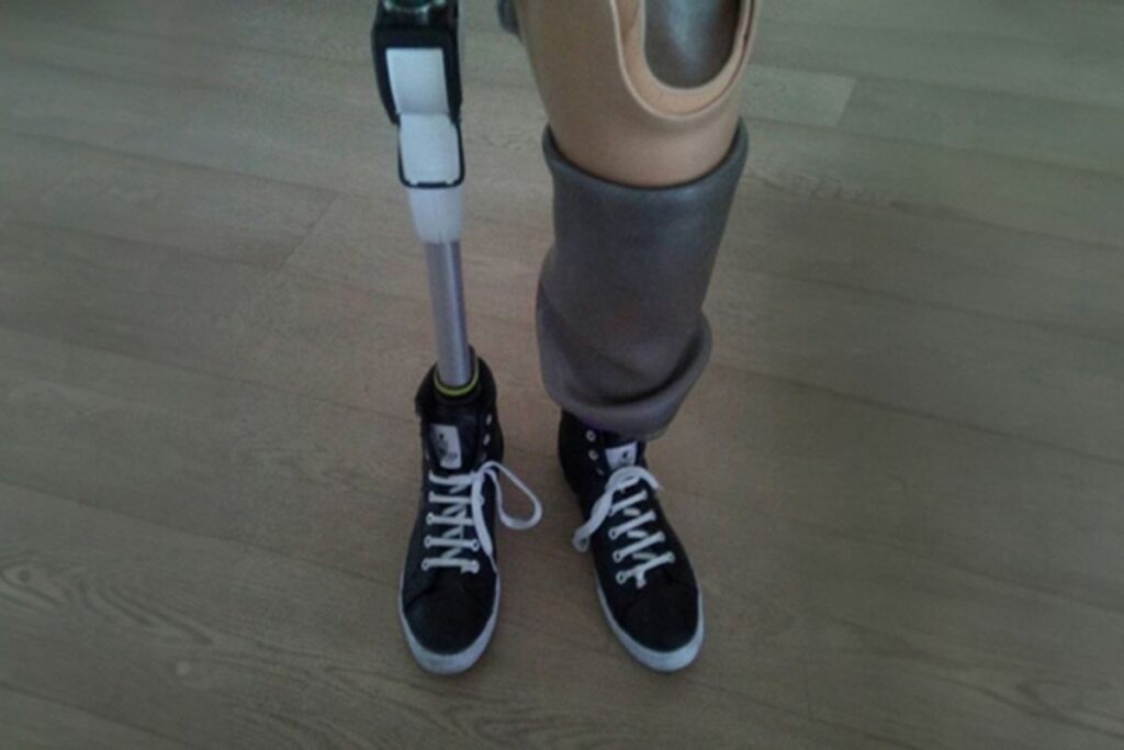 A person wearing two black sneakers, one on a prosthetic leg and the other on a natural leg with a prosthetic cover