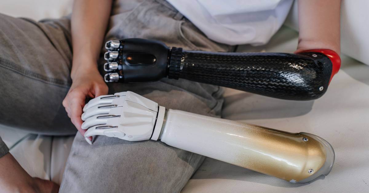 A person holding two different types of prosthetic arms, one with a sleek, black design and the other with a white and gold finish.