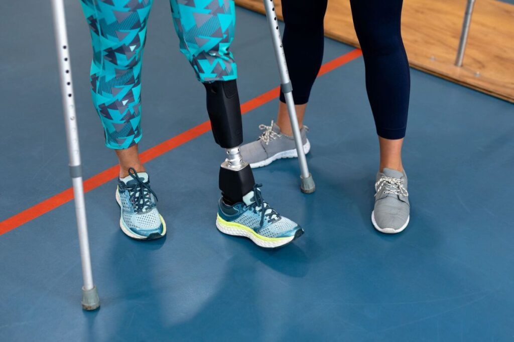 A person with a lower-leg prosthetic practices walking with crutches during rehabilitation.