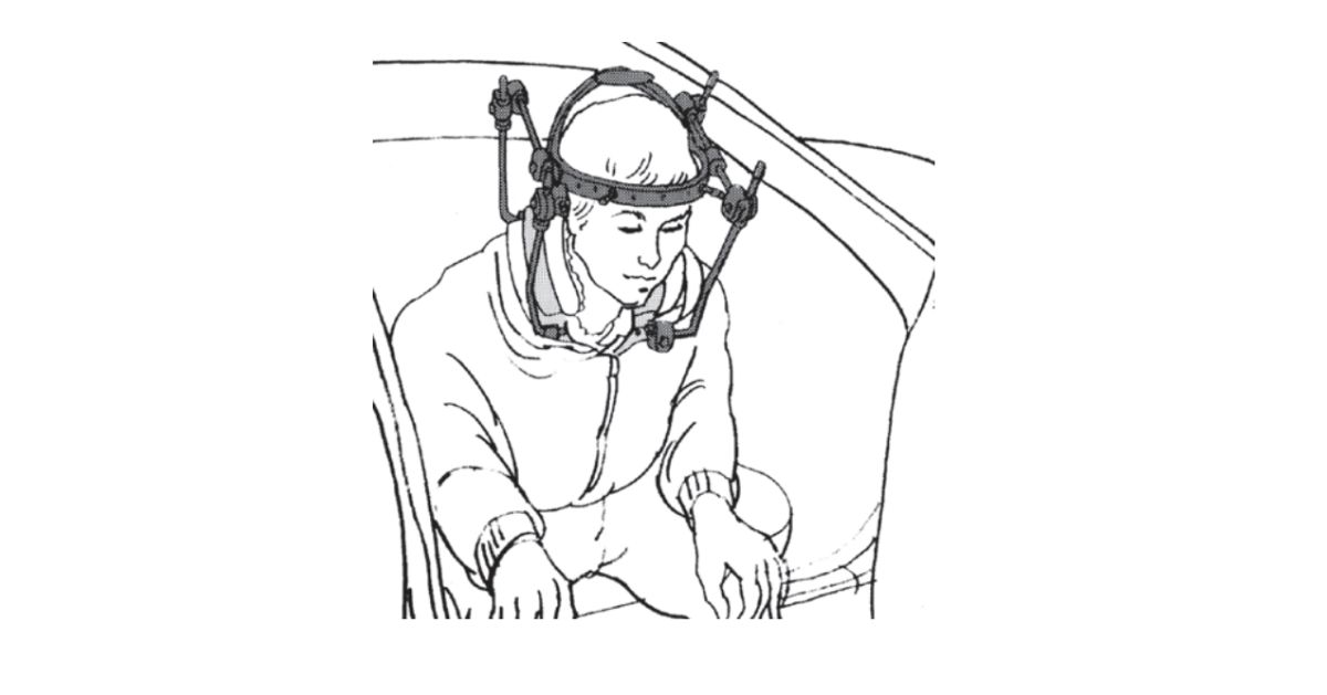 Illustration of a patient wearing a halo brace sitting upright to get in the car.