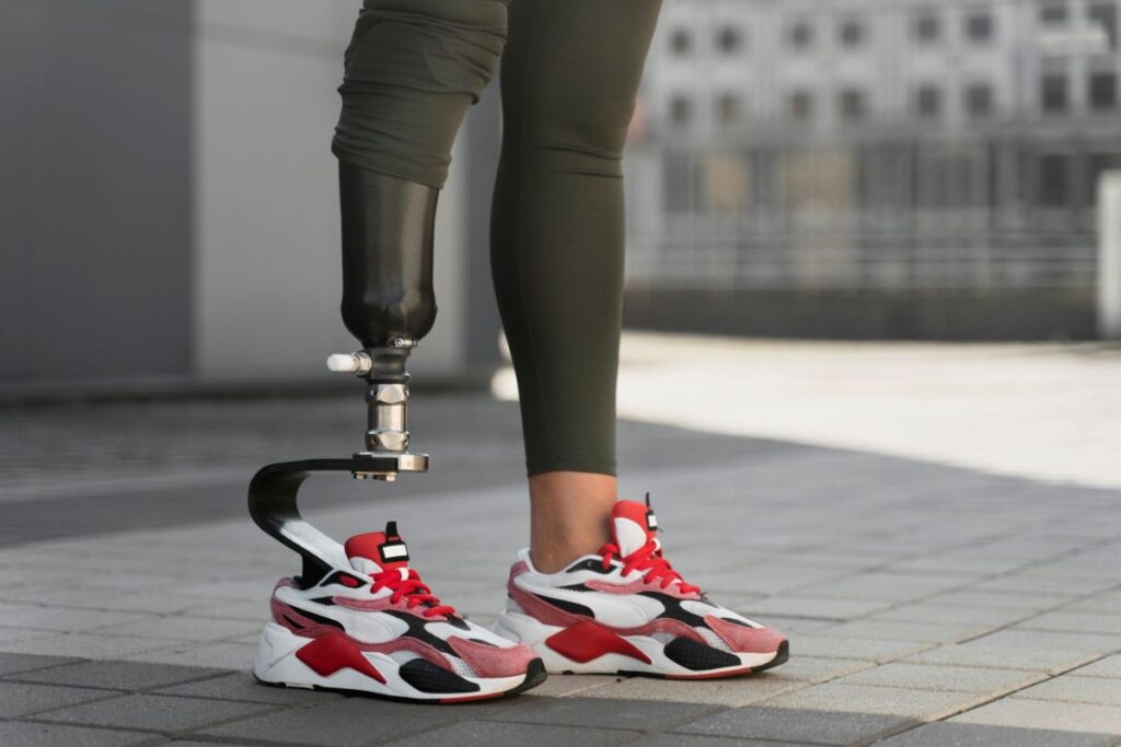 Person standing with a below-knee prosthetic leg and running shoes outdoors, showing a carbon fiber prosthetic foot.
