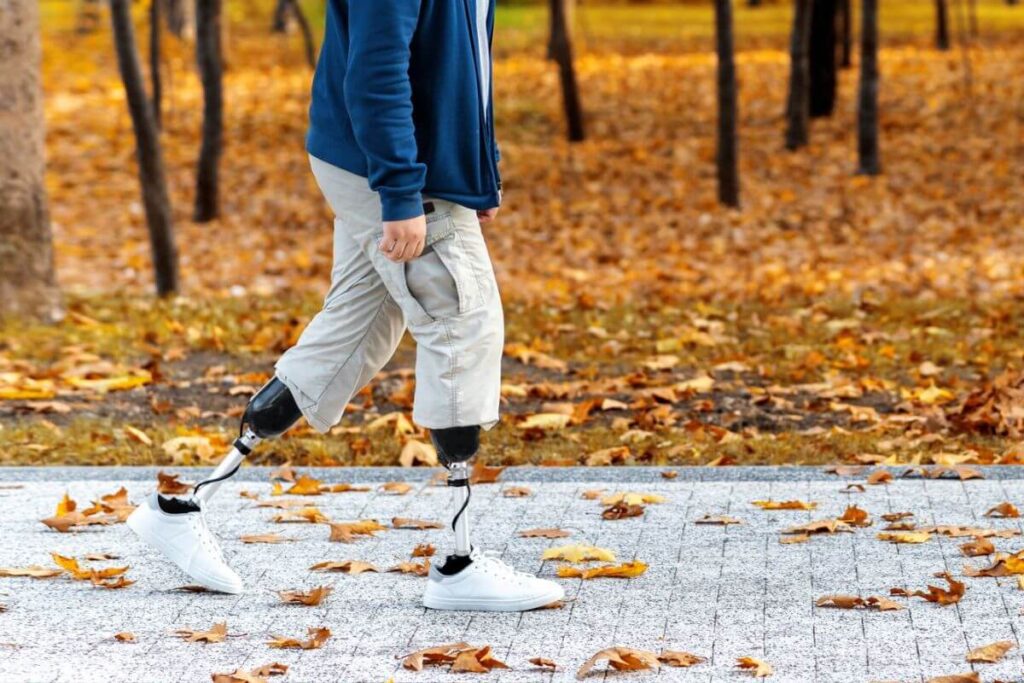 Person with bilateral below-knee prosthetic legs walking outdoors on a leaf-covered path while wearing everyday clothing and sneakers.