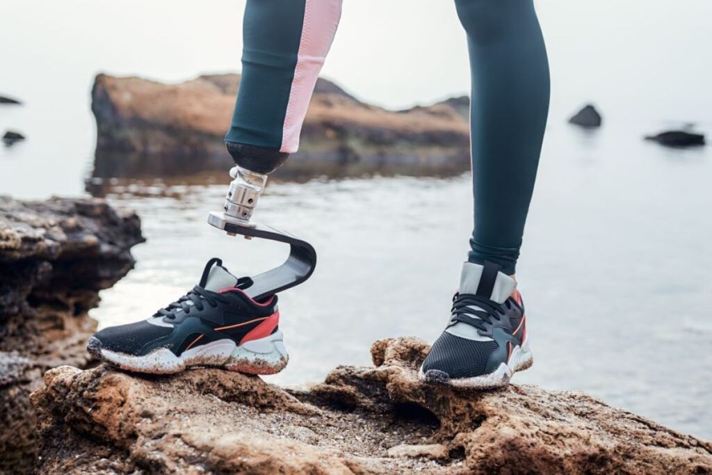 Person with a below-knee running prosthesis standing on rocks beside the water.