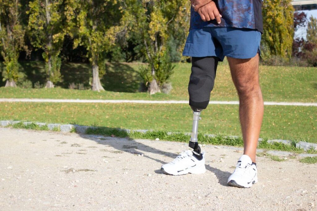Person standing outdoors with a prosthetic leg on a park path while wearing athletic clothing.
