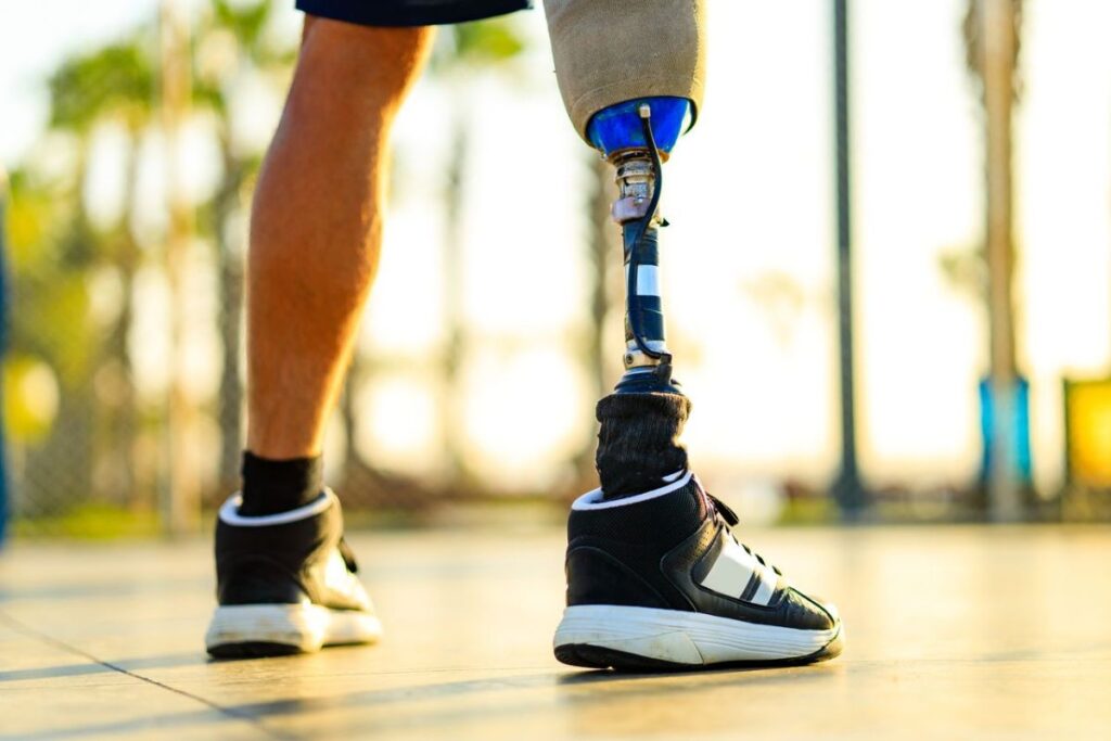 Close-up rear view of a person walking with a prosthetic leg while wearing athletic shoes outdoors.