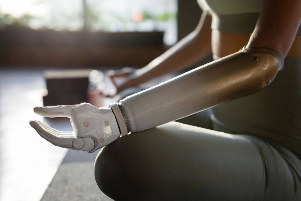 Person wearing a below-elbow prosthetic arm and hand